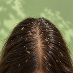 Lice Care