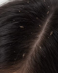 Lice Care